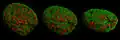 Cell nucleus in prophase from various angles