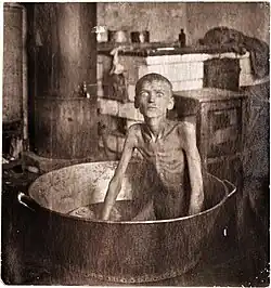 A starving boy from the village of Blagoveshchenka (Zaporizhzhia, Ukraine), who during the famine of 1921–1922 killed his three-year-old brother and ate him