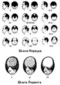 Alopecia scale