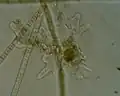 Amoeba, the archetypal amoebae