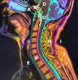 F: Posterior longitudinal ligament