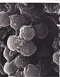 Bodo caudatus cysts