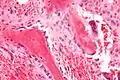 Osteoblasts lining bone (H&E stain)