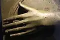 Bronze in the shape of a hand (Nemi ships)[68]