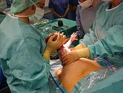 Pulling out the baby