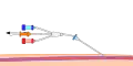 Step 5