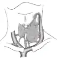 Diagram showing common arrangement of thyroid veins.