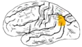 Lateral surface of left cerebral hemisphere, viewed from the side. Angular gyrus is shown in orange.