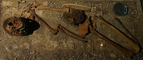 A skeleton lying upright, with some of its bones missing and its detached skull rolled over so that the chin pointing straight up