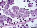 Haplosporidium species infect a variety of invertebrates