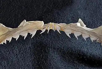 Upper teeth