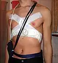 A Holter monitor can be worn for many days without causing significant discomfort.