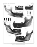 Radiography