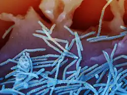 Filamentous RSV particles
