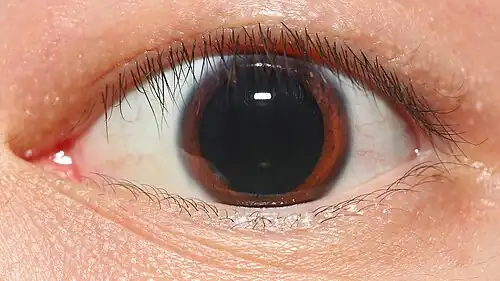 Pupils dilate in response to sexual arousal, and larger pupils are perceived to be more attractive.
