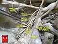 Female hypogastric artery