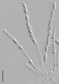 Ascus and spores
