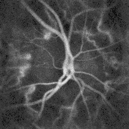 Blood flow in the optic disc revealed by holographic laser Doppler imaging.[4]