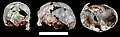 Burial 07 - Cranium