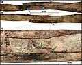 Burial 15. Perimortem fractures on the right radius