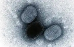 Negatively stained transmission electron micrograph of molluscum contagiosum virus virions