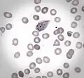 Nucleated red blood cell with Cabot rings and basophilic granules. May-Grunwald staining (x400)