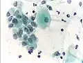Normal endocervical cells should be present into the slide, as a proof of a good quality sampling