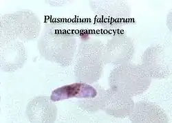 Photomicrograph of blood smear
