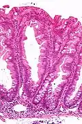 High magnification micrograph of a SSL showing crypt branching.