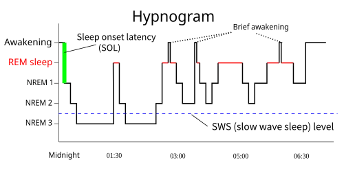 Hypnogram showing sleep cycles from midnight to morning.