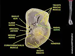Horizontal section of upper arm.