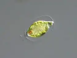 Trachelomonas sp. (Euglenales)