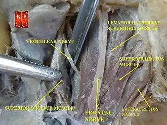 Lateral rectus muscle