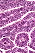 Very high magnification