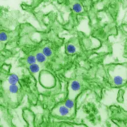 Electron micrograph of "Zika virus". Virus particles (colored purple) are 40&nbsp;nm in diameter, with an outer envelope and a dense inner core.